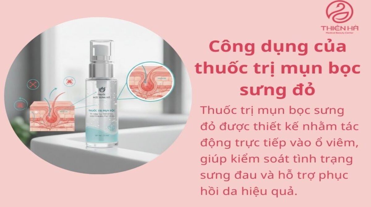 Top 5 thuốc trị mụn bọc sưng đỏ được tin dùng và an toàn cho da
