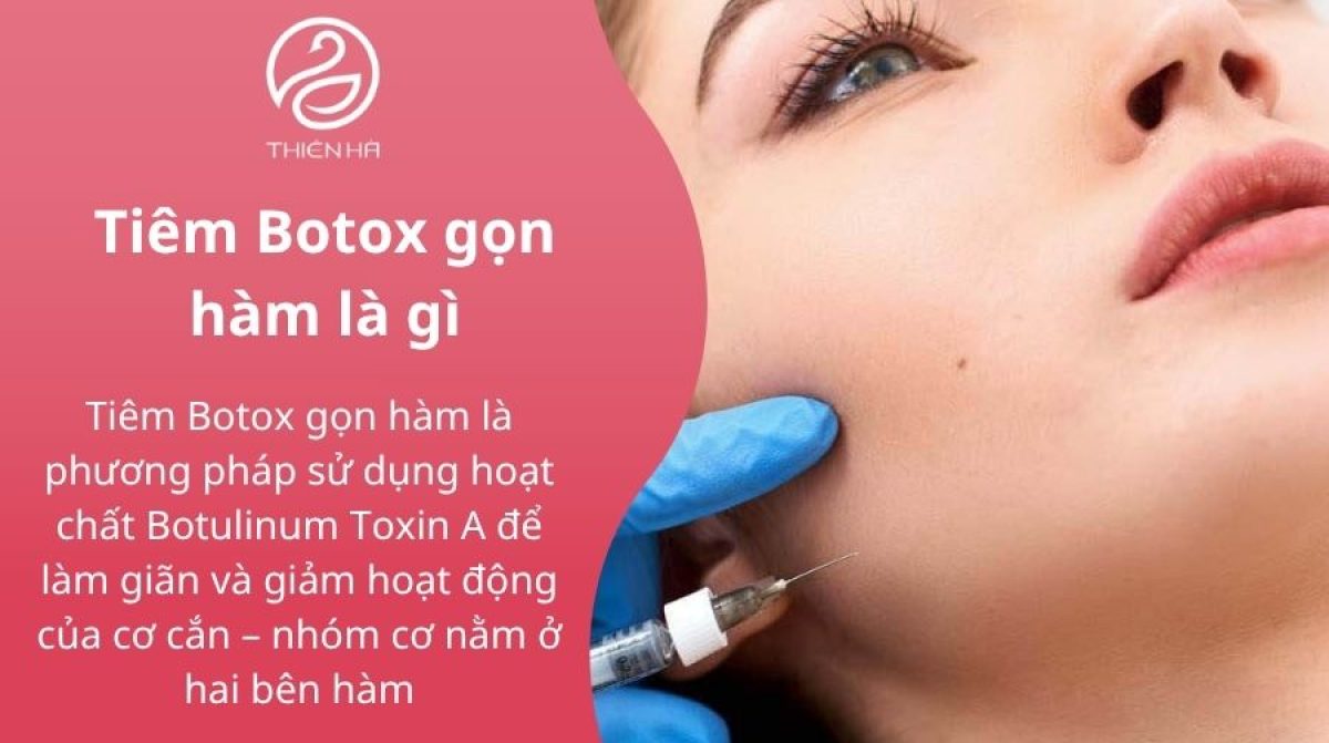 Tiêm Botox gọn hàm: Hiệu quả, Chi phí và Lưu ý quan trọng tại TMV Thiên Hà