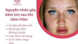 Tiêm Filler Bị Bầm: Nguyên Nhân, Cách Xử Lý và Phòng Ngừa Hiệu Quả | TMV Thiên Hà