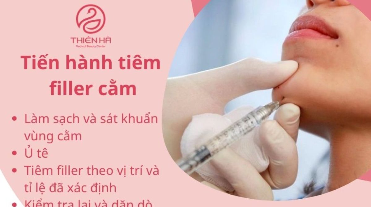 Tiêm Filler Cằm: Tạo Dáng V-line Thon Gọn, An Toàn Tại TMV Thiên Hà