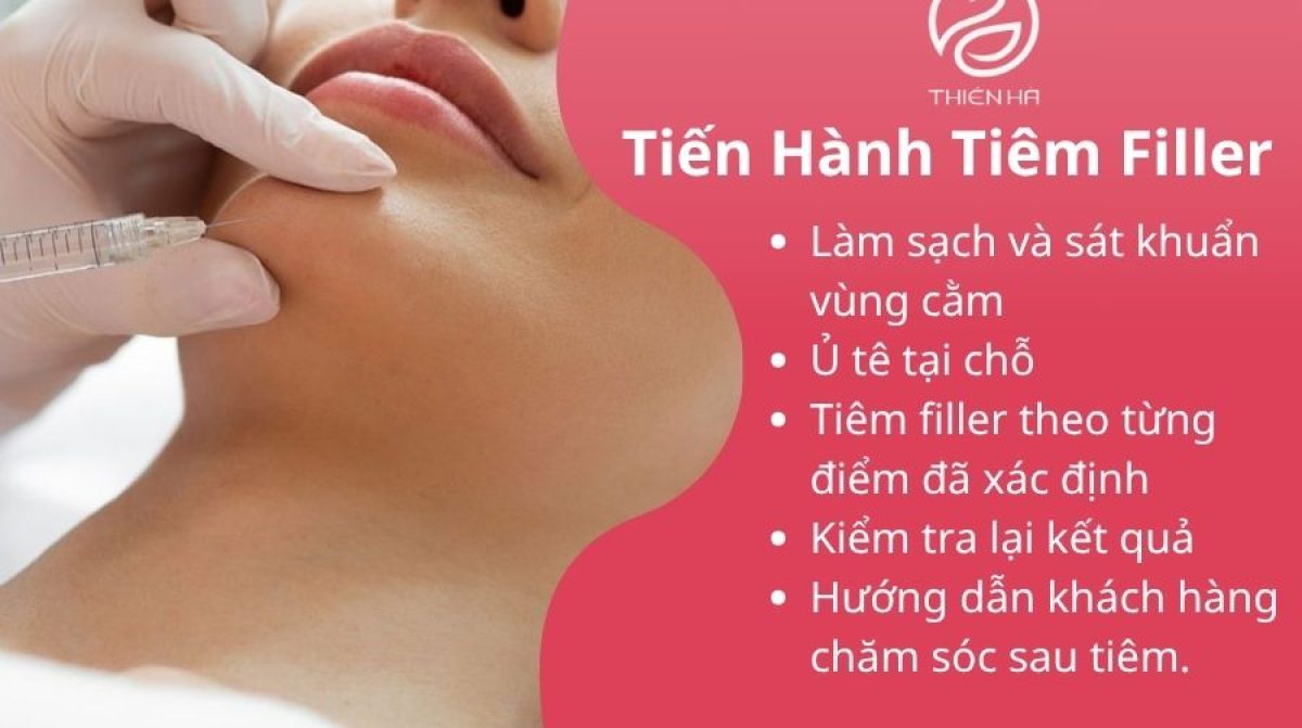Tiêm Filler Cằm Bao Lâu Thì Đẹp? Quy Trình & Lưu Ý Quan Trọng