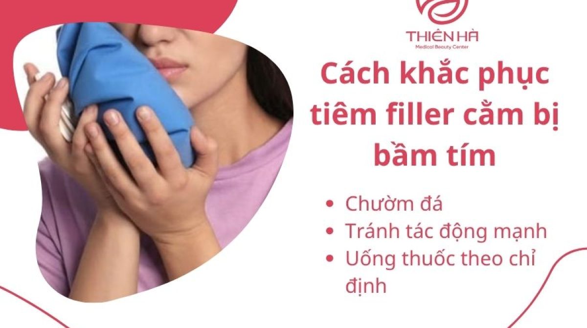 Tiêm Filler Cằm Bị Bầm Tím: Nguyên Nhân và Cách Khắc Phục Hiệu Quả