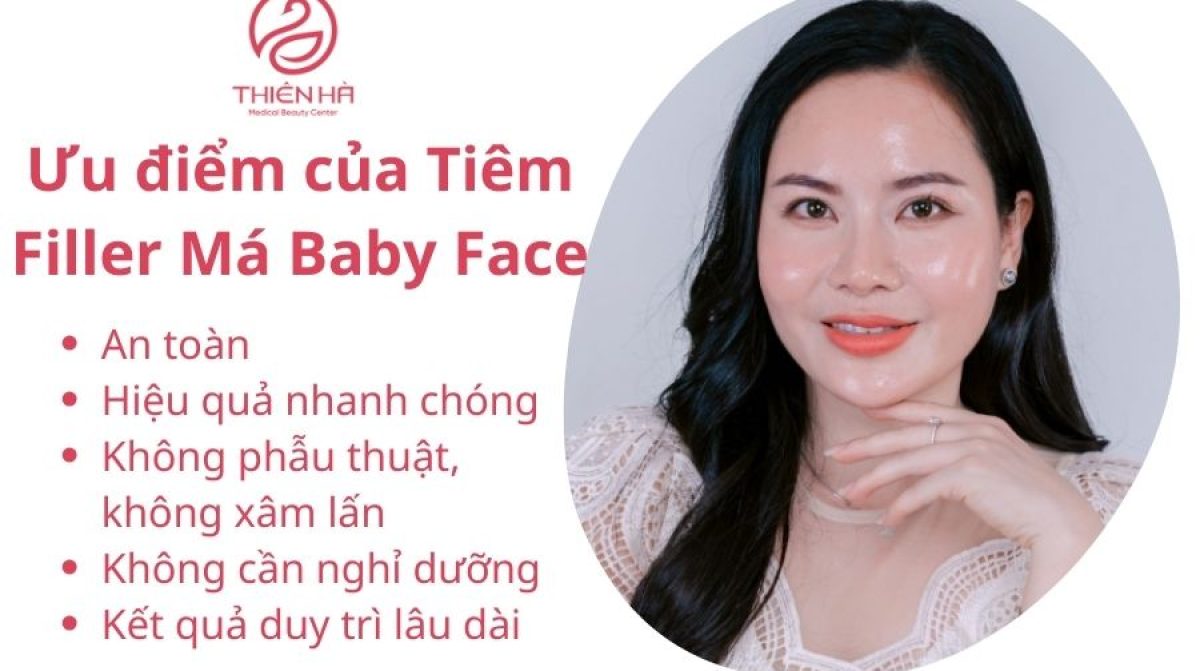 Tiêm Filler Má Baby Face: Giá Bao Nhiêu, Ưu Nhược Điểm & Quy Trình