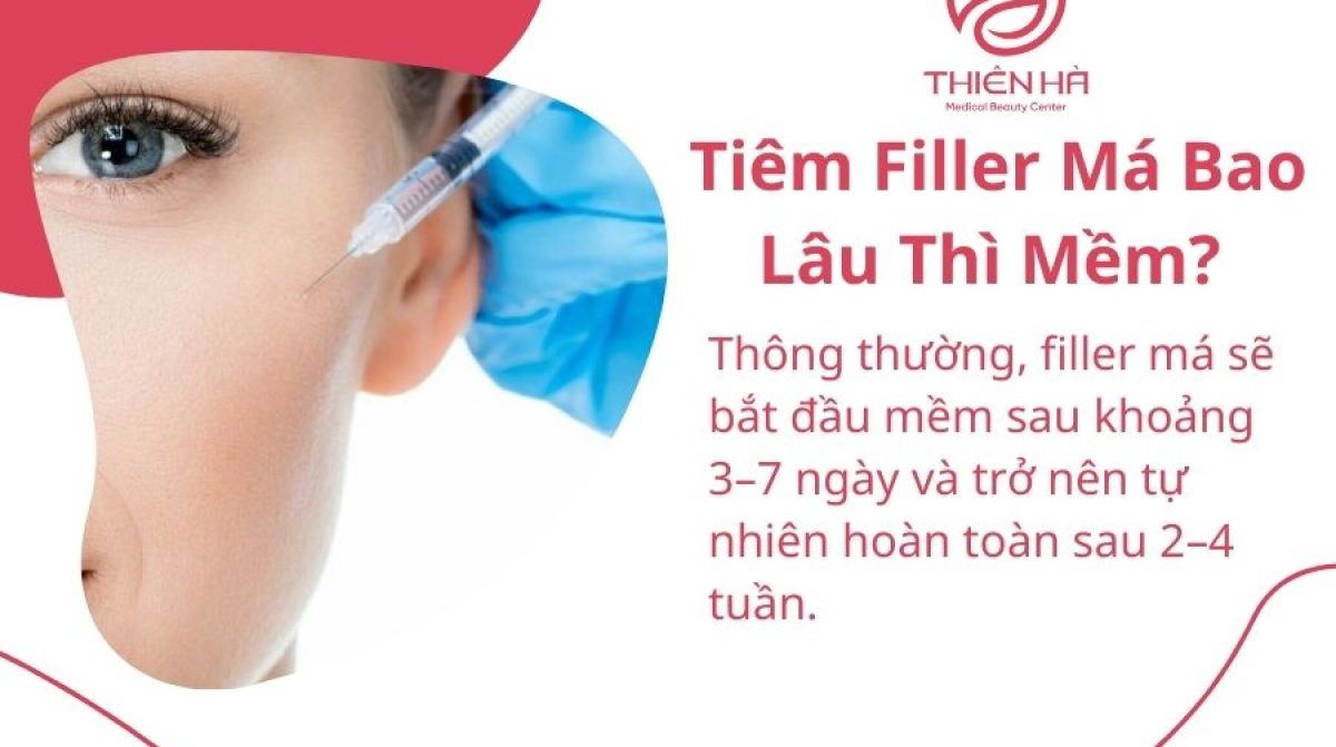 Tiêm Filler Má Bao Lâu Thì Mềm? Chuyên Gia Giải Đáp