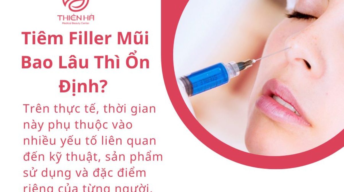 Tiêm Filler Mũi Bao Lâu Thì Ổn Định? | Tư Vấn Chuyên Gia