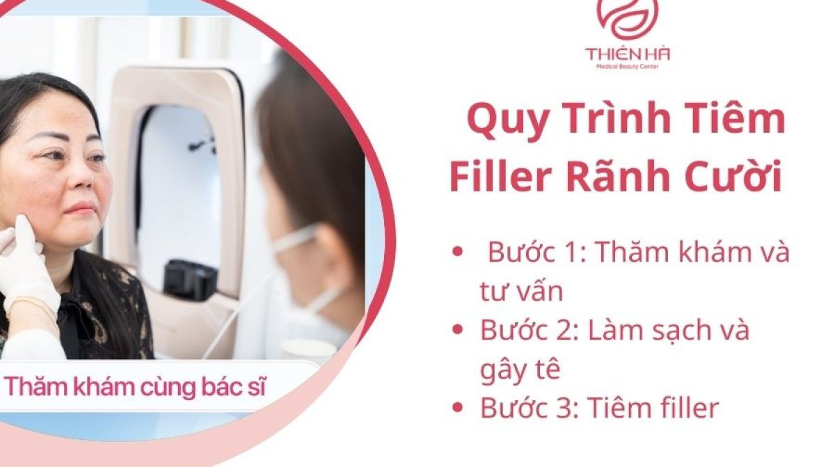 Tiêm Filler Rãnh Cười: Lợi Ích, Nguy Hiểm & Quy Trình An Toàn Tại TMV Thiên Hà