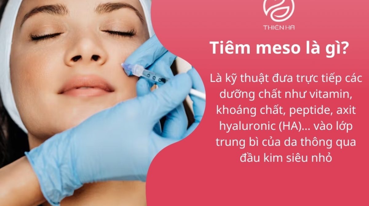 Tiêm meso có tác dụng gì? Lợi ích & lưu ý quan trọng
