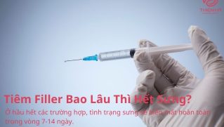 Tiêm Filler Bao Lâu Thì Hết Sưng? Chuyên Gia Giải Đáp