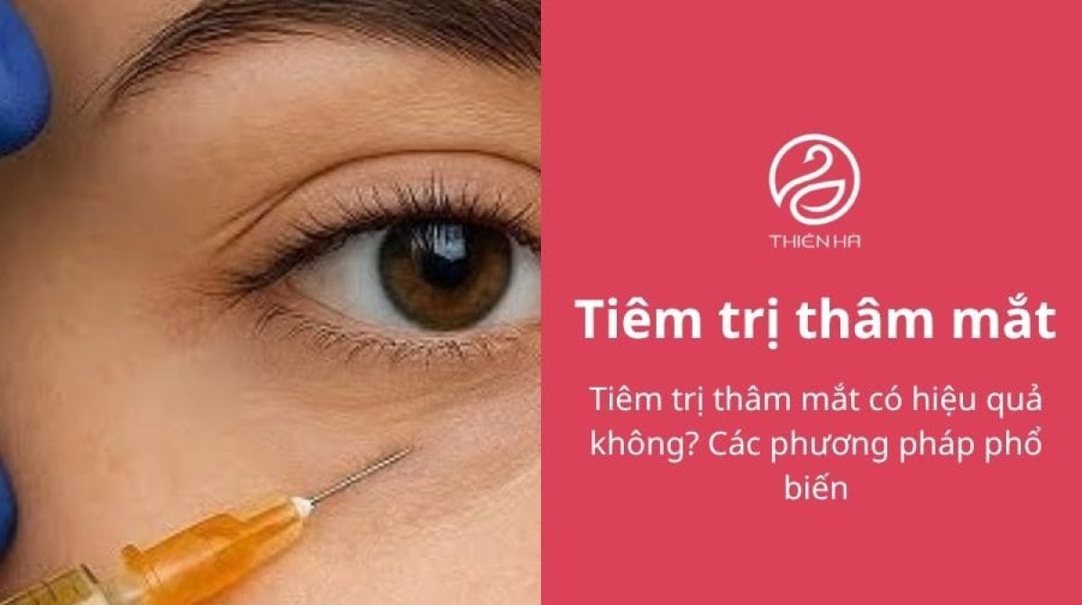 Tiêm trị thâm mắt có hiệu quả không? Các phương pháp phổ biến