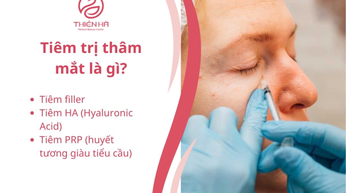 Tiêm trị thâm mắt: Giải pháp tối ưu cho vùng da quanh mắt 
