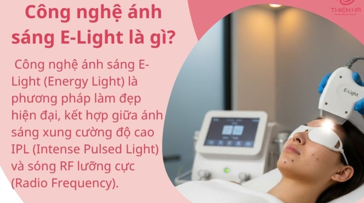 Trị sẹo thâm bằng E-Light: Ưu điểm, chi phí và chăm sóc sau điều trị
