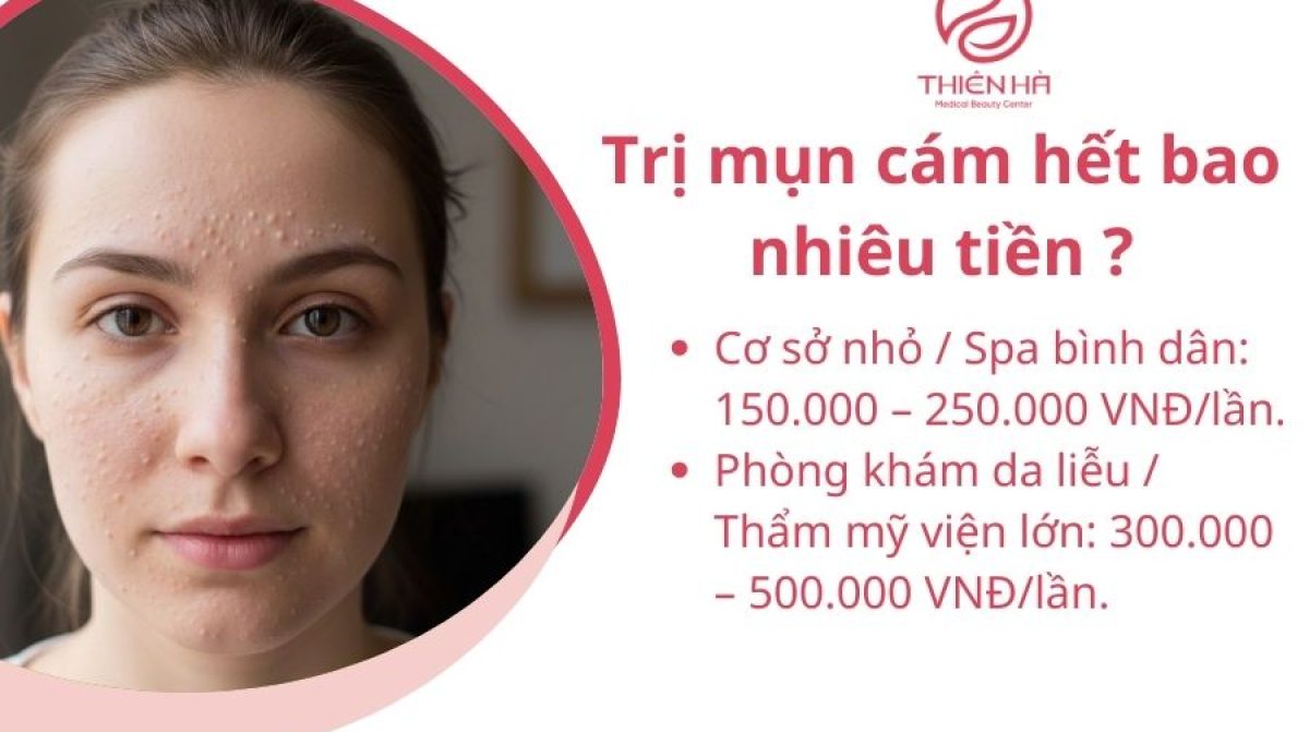 Trị mụn cám hết bao nhiêu tiền? Bảng giá chi tiết tại spa, clinic da liễu