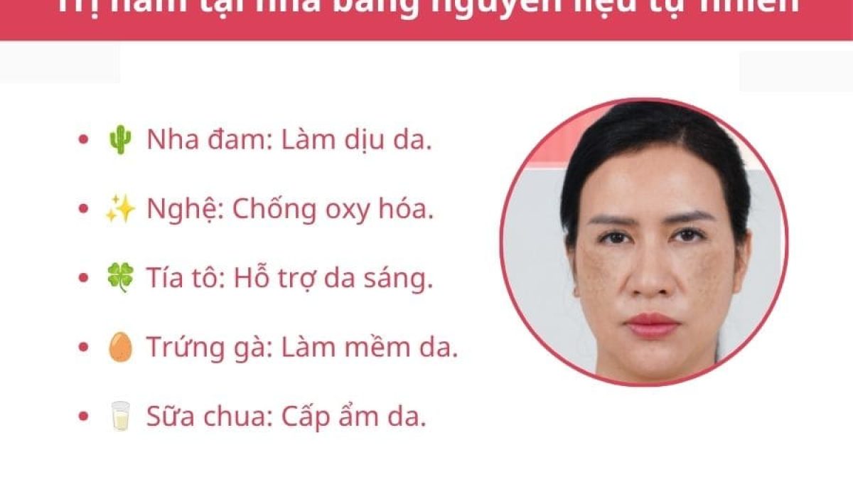 Tổng hợp cách trị nám da hiệu quả: Tự nhiên, mỹ phẩm, công nghệ