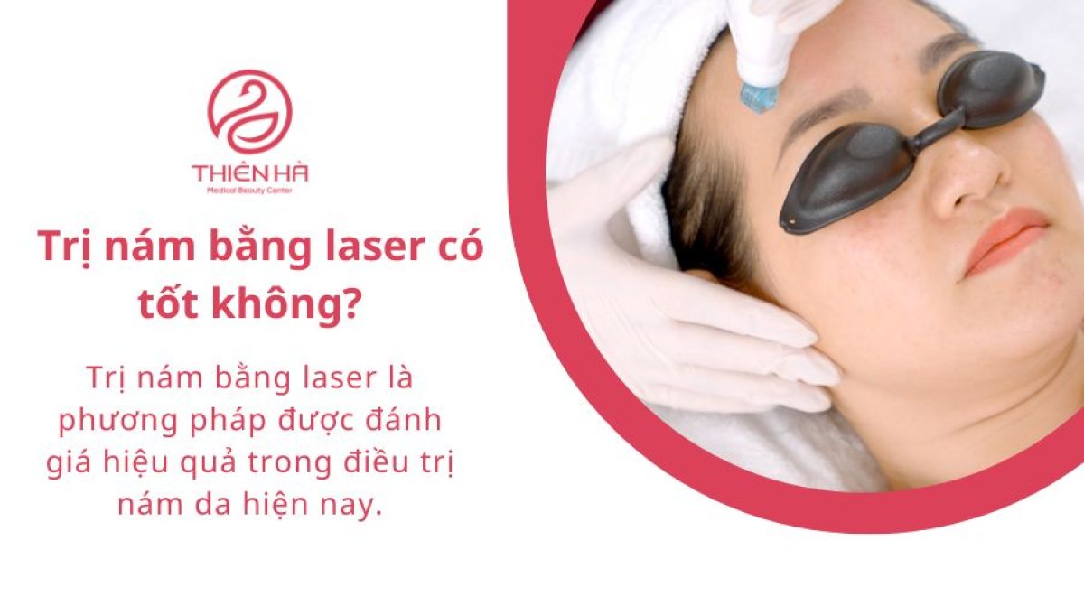 Trị nám bằng laser bao nhiêu tiền? Giá từng công nghệ mới nhất