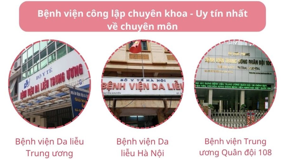 Trị nám ở đâu tốt nhất Hà Nội? Top địa chỉ uy tín