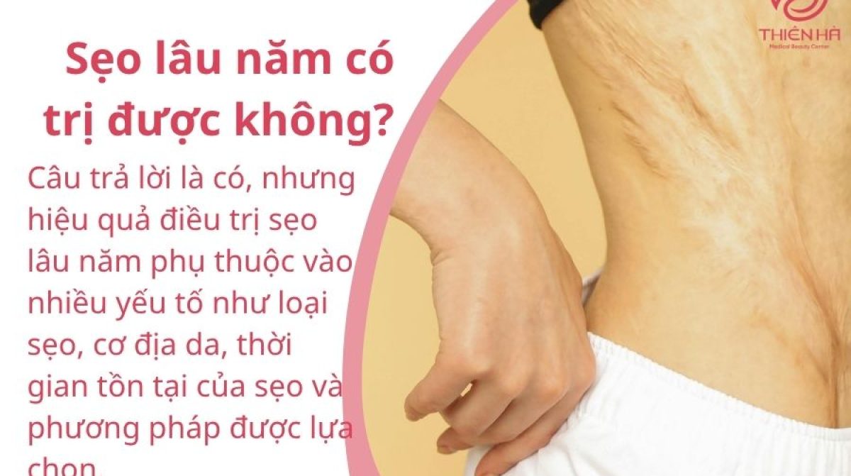 Trị sẹo lâu năm hiệu quả: Phương pháp nào tốt nhất cho bạn?