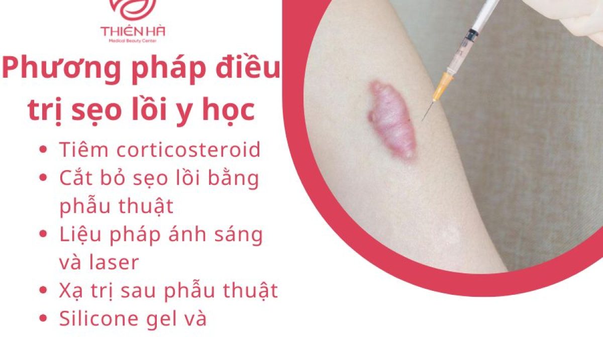 Trị Sẹo Lồi Hiệu Quả – Các Phương Pháp An Toàn & Ngăn Ngừa Tái Phát