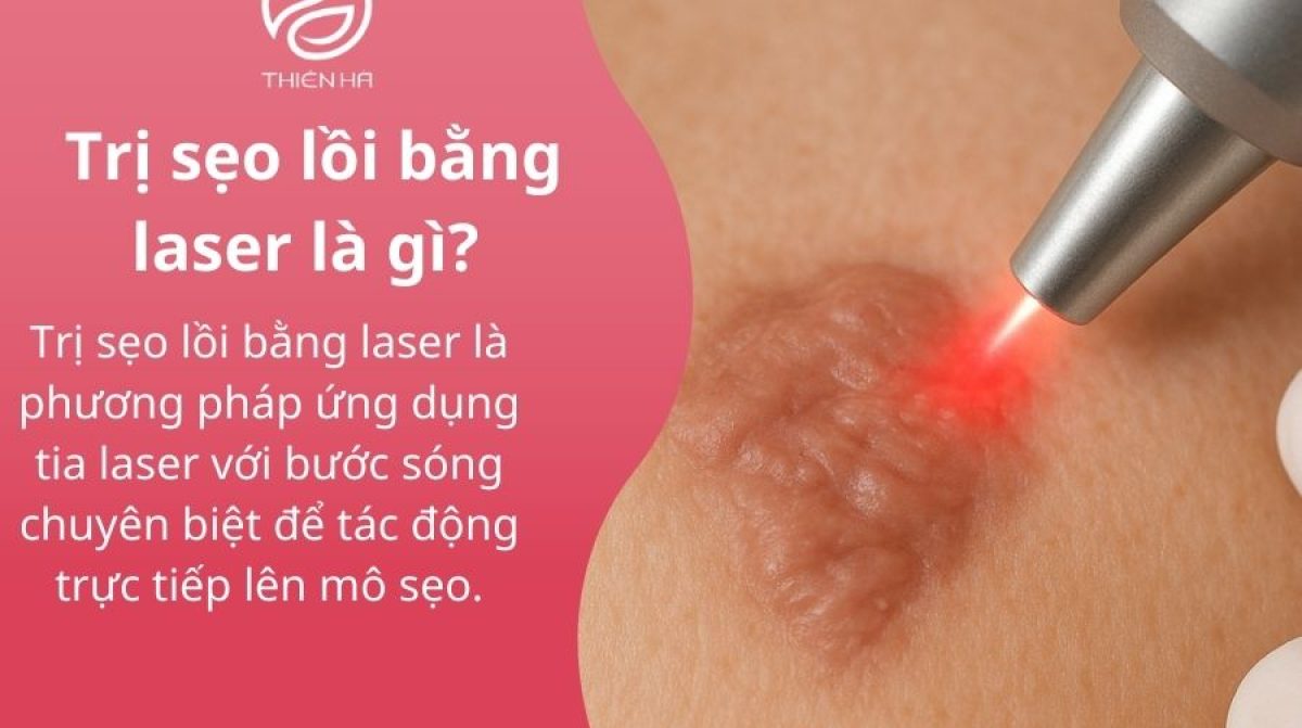 Trị sẹo lồi bằng laser: Công nghệ mới và quy trình hiệu quả