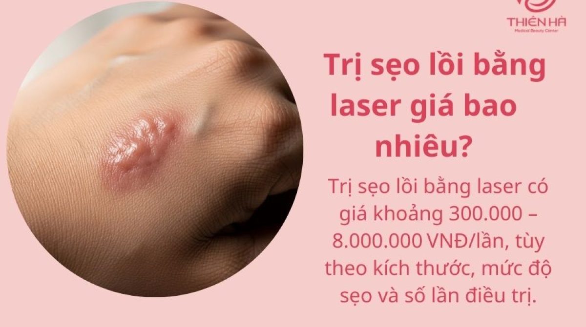Trị Sẹo Lồi Bằng Laser Giá Bao Nhiêu? Thẩm Mỹ Viện Thiên Hà