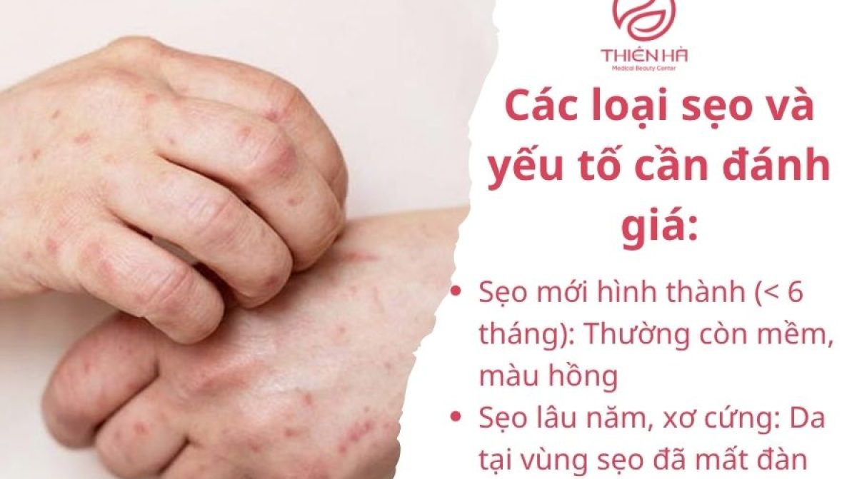 Trị sẹo thủy đậu hiệu quả: Từ mẹo tự nhiên đến công nghệ mới