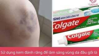 Trị thâm đầu gối bằng kem đánh răng: Hướng dẫn chi tiết, an toàn