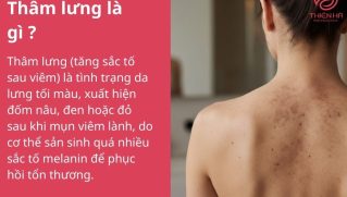 Trị thâm lưng hiệu quả, an toàn từ nguyên nhân đến giải pháp