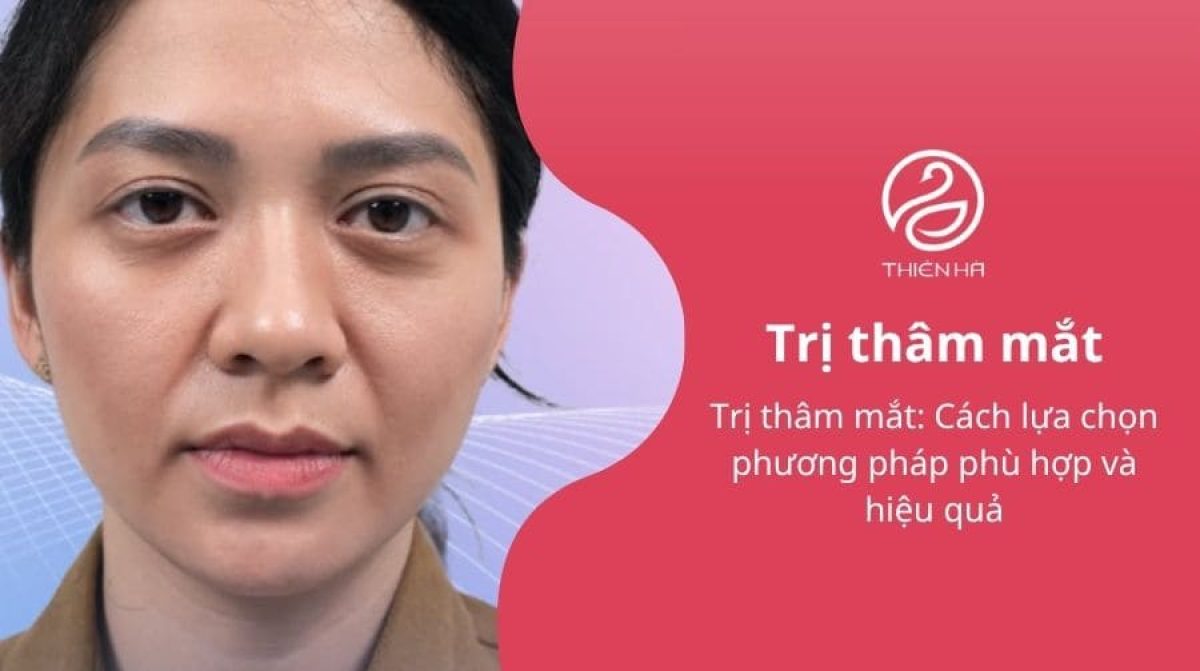Trị thâm mắt: Cách lựa chọn phương pháp phù hợp và hiệu quả