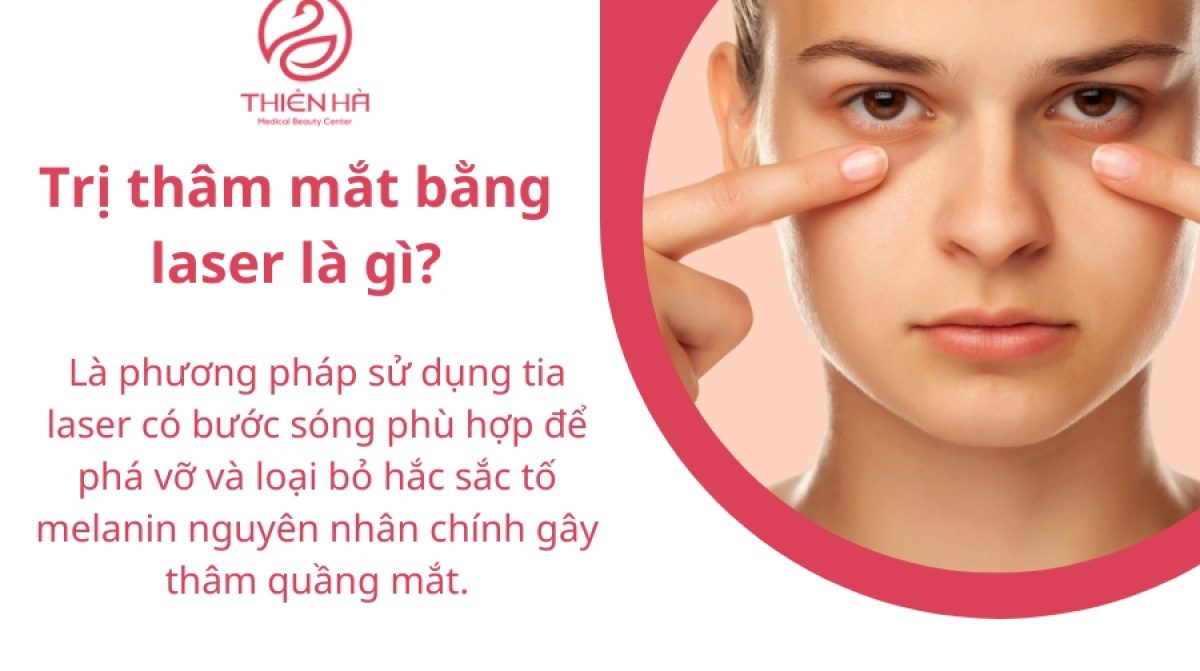 Trị thâm mắt bằng laser: Giải pháp cho đôi mắt tươi trẻ