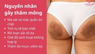 Trị thâm mông nhanh với Vaseline: 5 cách đơn giản tại nhà