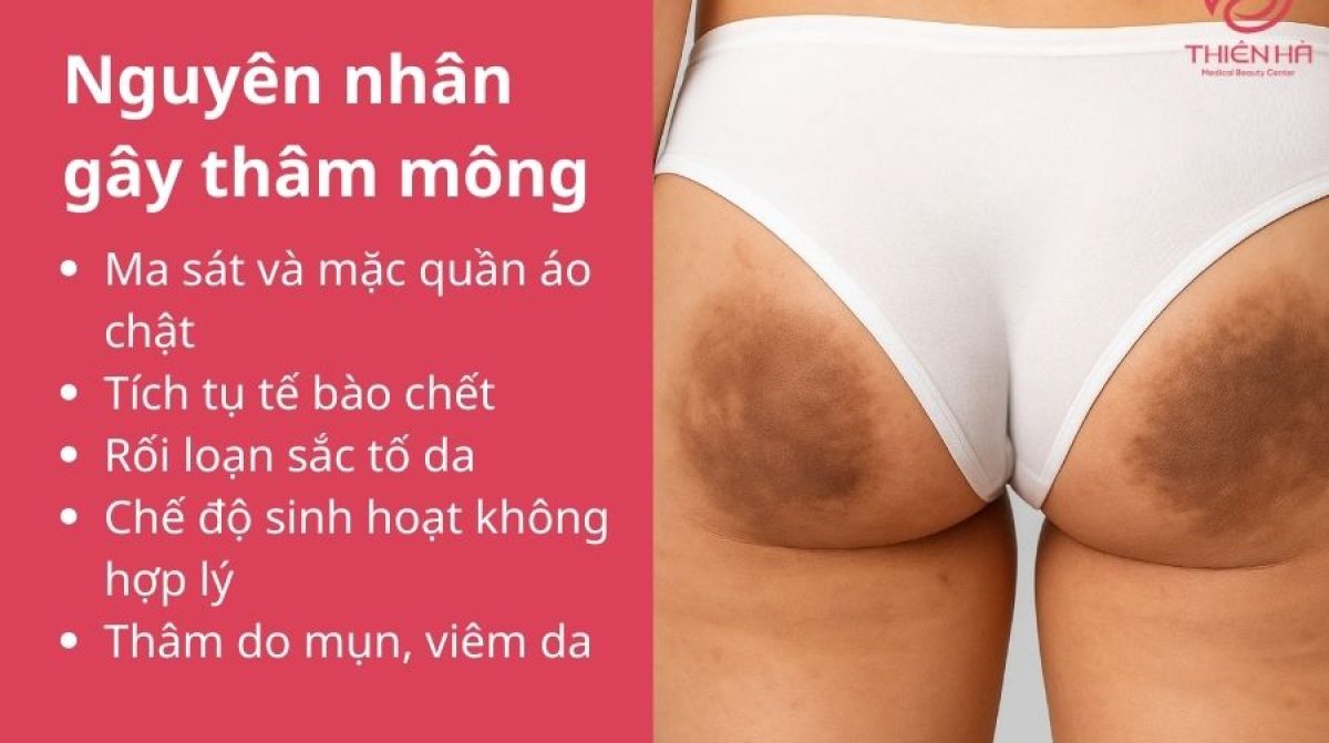 Trị thâm mông nhanh với Vaseline: 5 cách đơn giản tại nhà