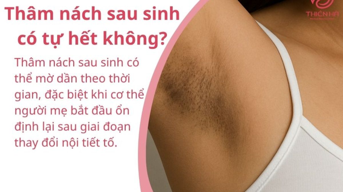 Trị thâm nách sau sinh an toàn hiệu quả cho mẹ bỉm sữa
