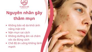 Trị thâm tại nhà: 10+ cách hiệu quả giúp da sáng mịn tự nhiên