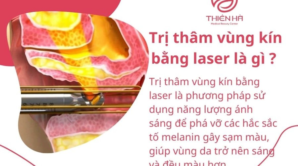 Trị thâm vùng kín bằng Laser: Phương pháp hiện đại, nhanh chóng, ít xâm lấn