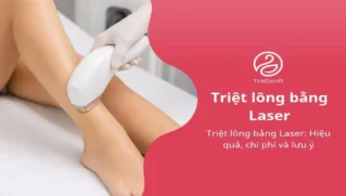 Triệt lông bằng Laser: Hiệu quả, chi phí và lưu ý