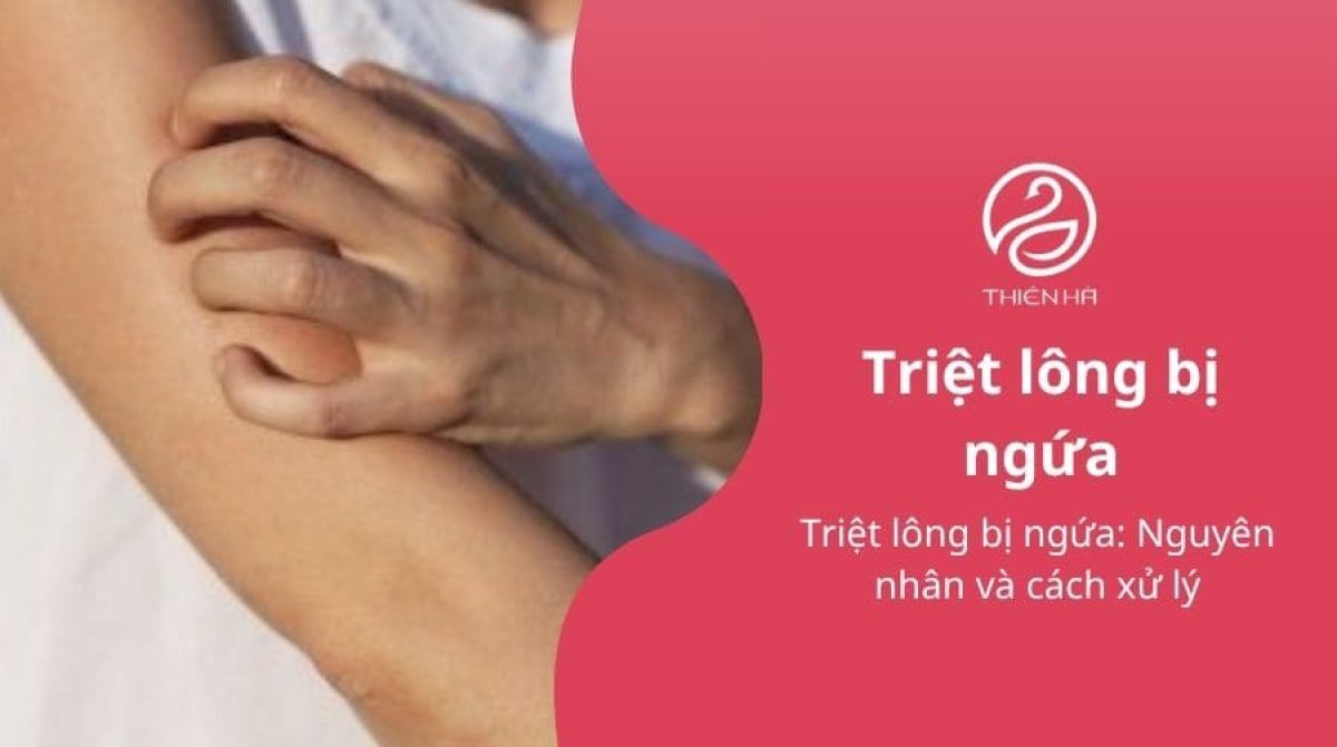 Triệt lông bị ngứa: Nguyên nhân và cách xử lý