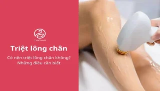 Có nên triệt lông chân không? Những điều cần biết