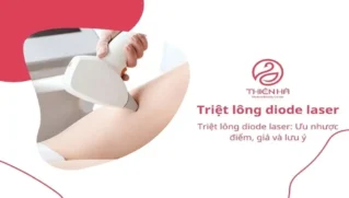 Triệt lông diode laser: Ưu nhược điểm, giá và lưu ý