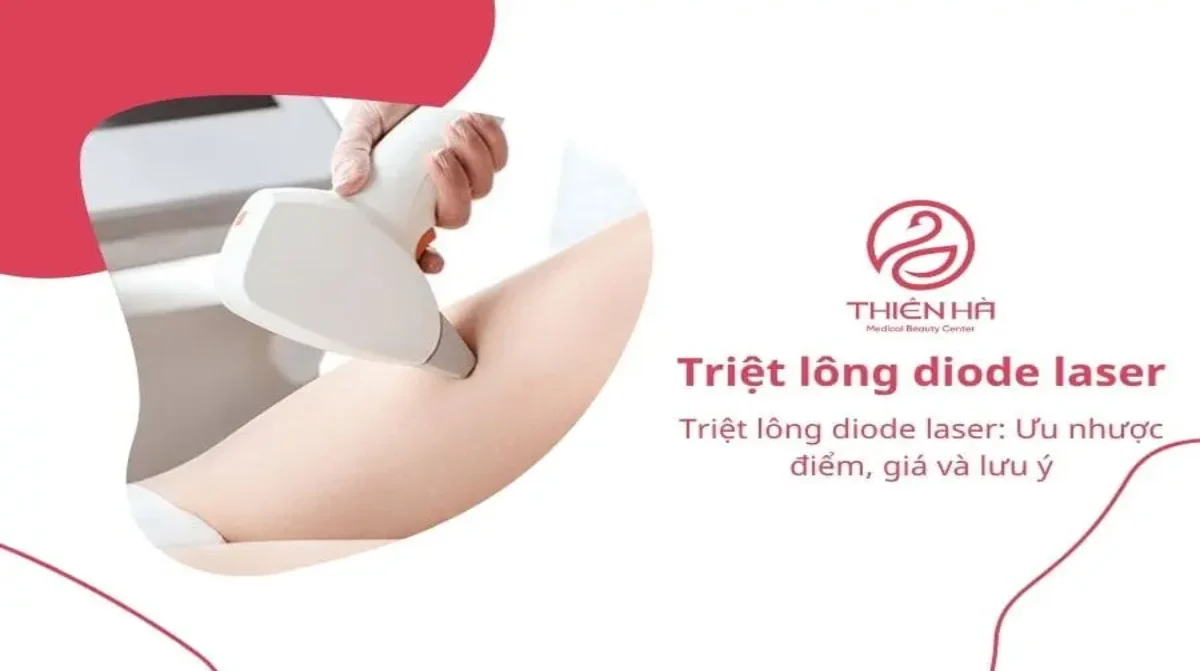 Triệt lông diode laser: Ưu nhược điểm, giá và lưu ý