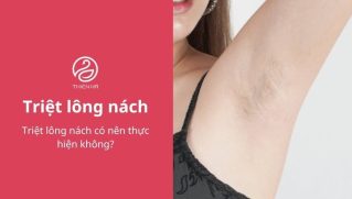 Triệt lông nách có nên thực hiện không?