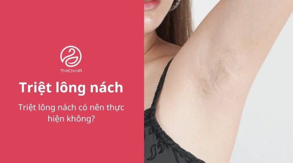 Triệt lông nách có nên thực hiện không?