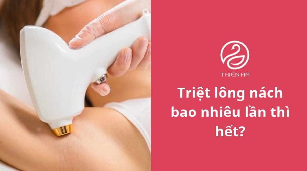Triệt lông nách bao nhiêu lần thì hết?