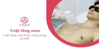 Triệt lông nam theo từng vùng cơ thể