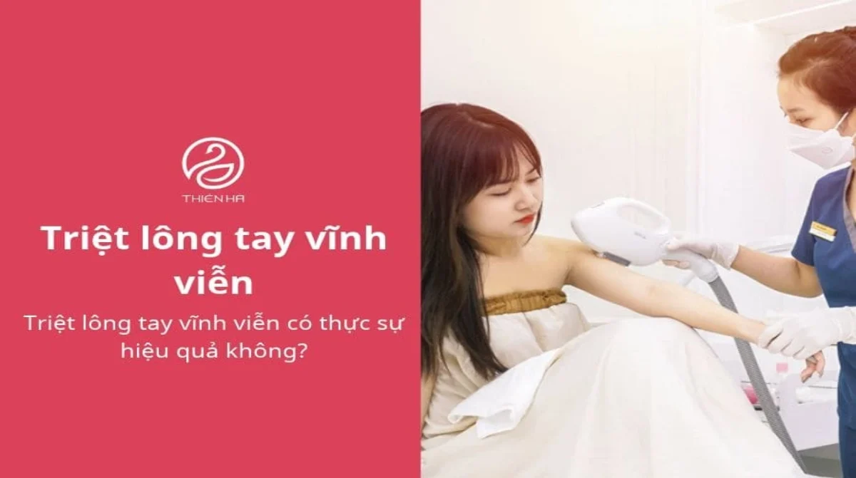 Triệt lông tay vĩnh viễn có thực sự hiệu quả không?