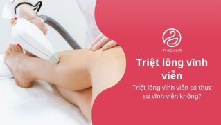 Triệt lông vĩnh viễn có thực sự vĩnh viễn không?