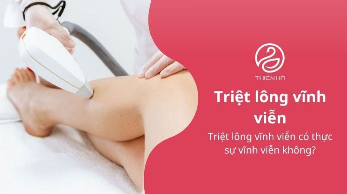 Triệt lông vĩnh viễn có thực sự vĩnh viễn không?