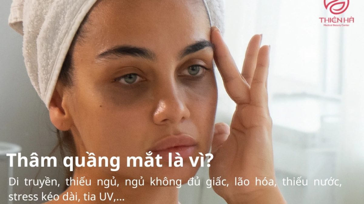 Uống gì để trị thâm quầng mắt? 10+ thức uống “thần thánh”