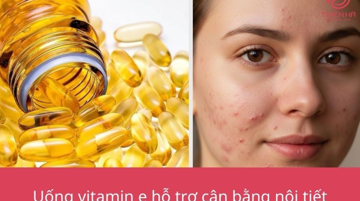 Uống vitamin E trị mụn nội tiết có hiệu quả không và cách dùng đúng