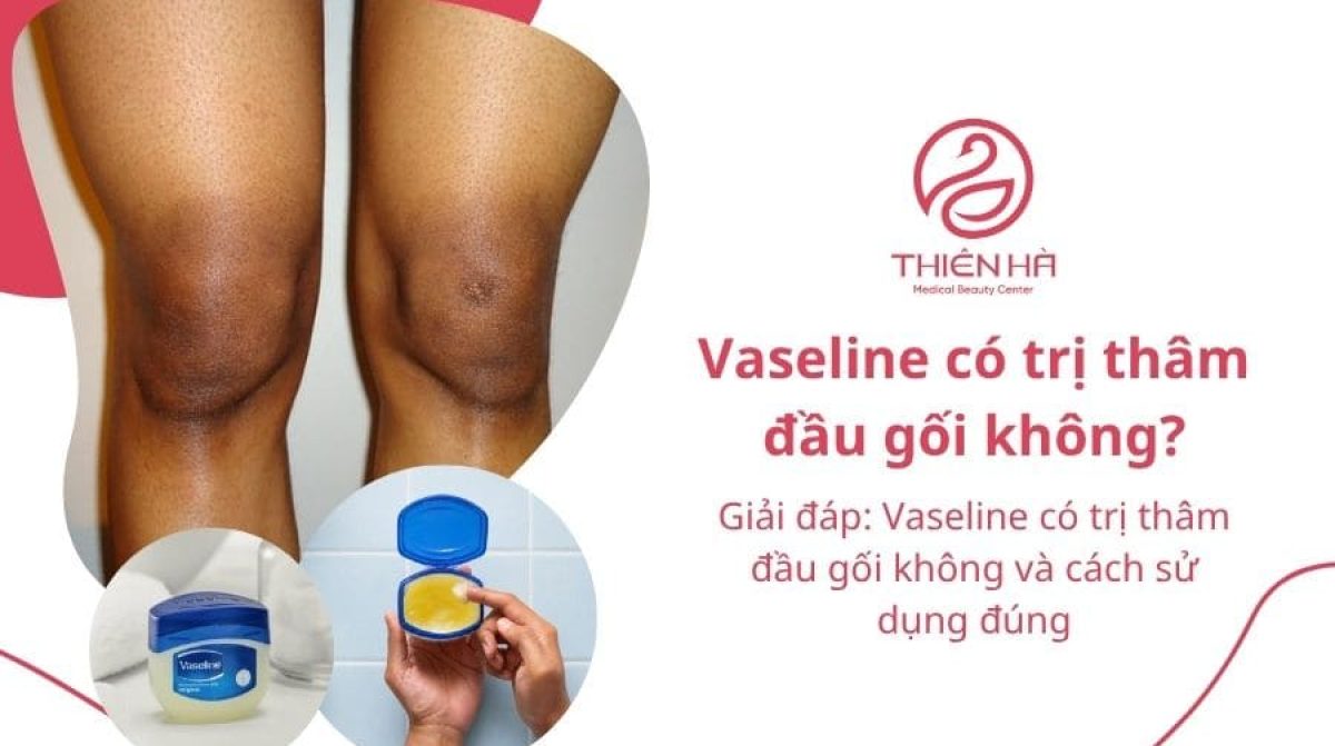 Giải đáp: Vaseline có trị thâm đầu gối không và cách sử dụng đúng