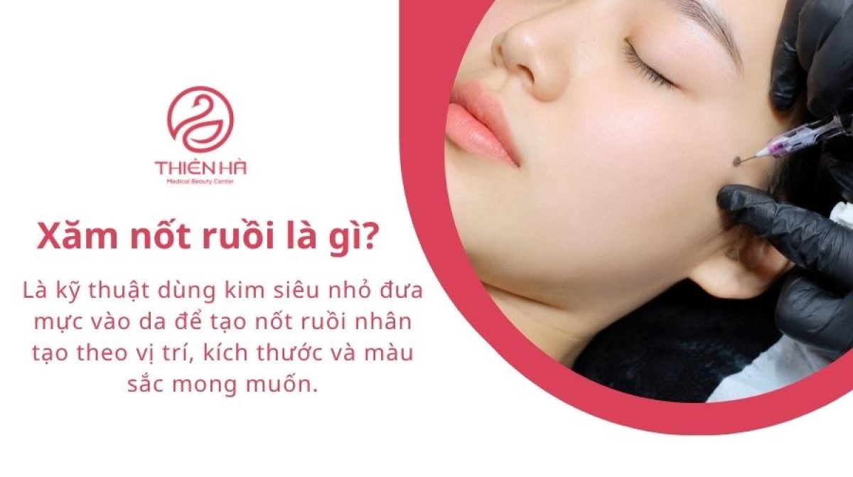Xăm nốt ruồi có nên không? Vị trí, ý nghĩa và chi phí cần biết