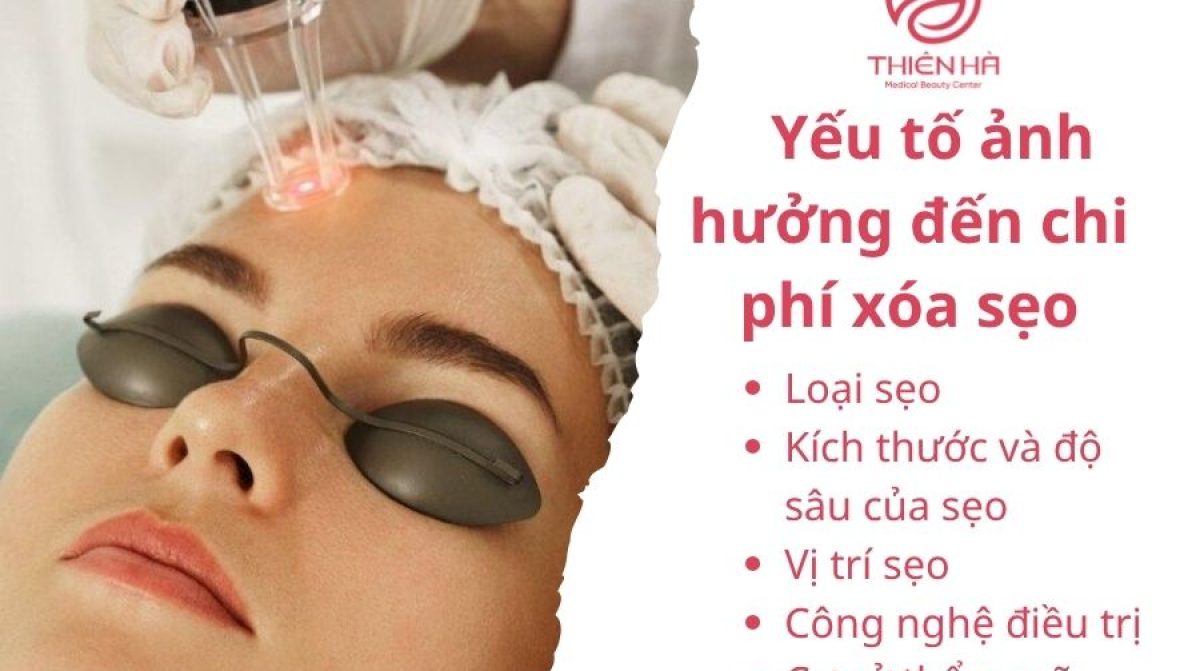 Xóa sẹo lâu năm giá bao nhiêu? Bảng giá chi tiết  tại TMV Thiên Hà
